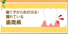歯ぐきから血が出る・腫れている 歯周病