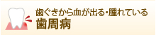 歯ぐきから血が出る・腫れている 歯周病